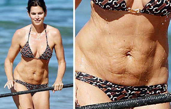 Como Acabar com a Flacidez da Barriga